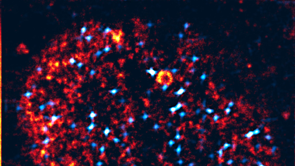 Microscopy of a nucleus: Transcription factories are colored orange, activated genes light blue. The nucleus has about one tenth of the thickness of a human hair. (Figure: Working groups Nienhaus and Hilbert, KIT) 