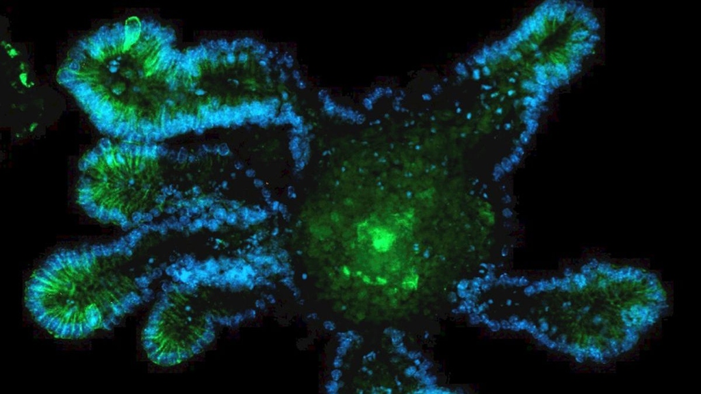 Mithilfe von 3D-Organoiden (blau) kann der Einfluss des Proteins CD44 (grün) auf die Darmregeneration untersucht werden. (Foto: Romina Walter, KIT) 