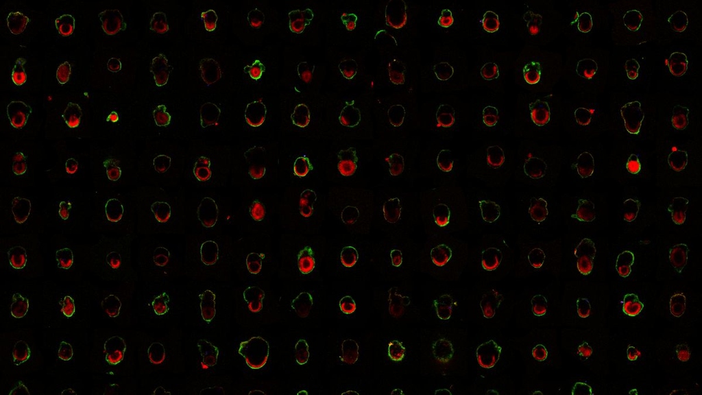 KI erkennt normal entwickelte Embryos